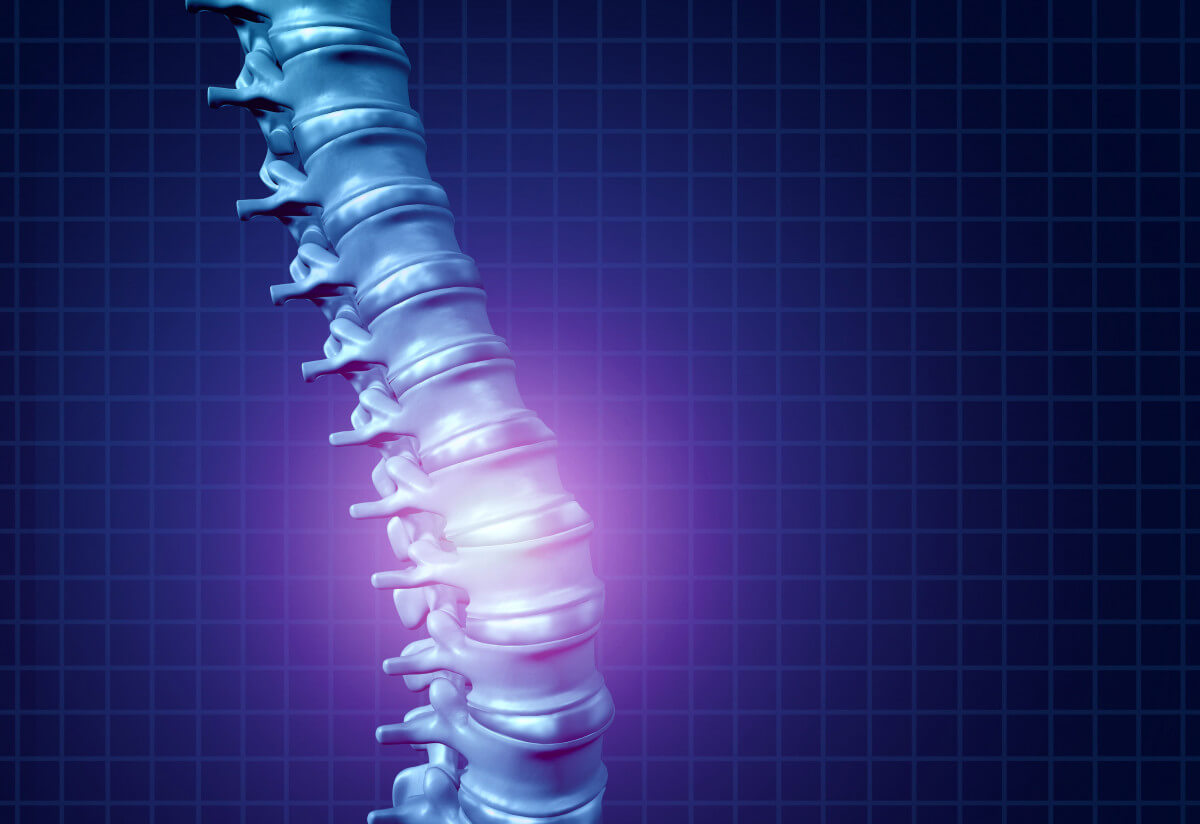 Spinal stenosis, diagnosis and treatments