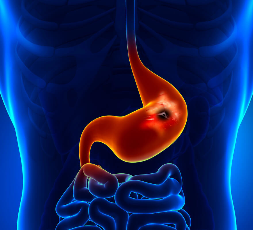 Decoding Gastroenterology: Your Path to a Happy Gut in Burleson, TX